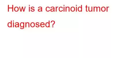 How is a carcinoid tumor diagnosed?