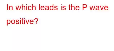 In which leads is the P wave positive?