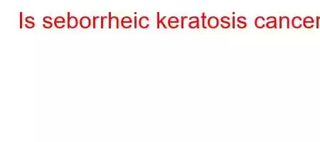 Is seborrheic keratosis cancer?