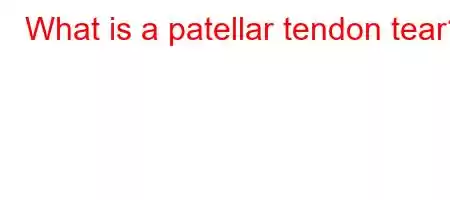 What is a patellar tendon tear?