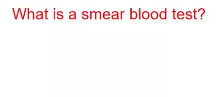 What is a smear blood test