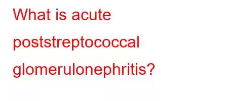 What is acute poststreptococcal glomerulonephritis