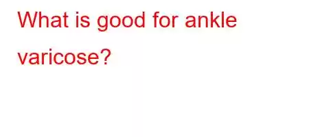 What is good for ankle varicose?