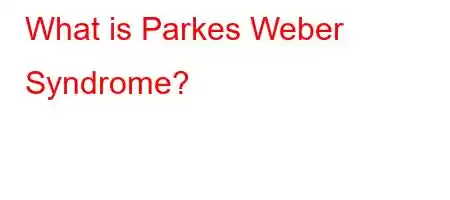 What is Parkes Weber Syndrome