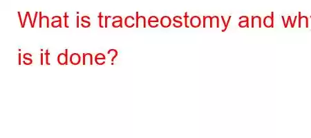 What is tracheostomy and why is it done?