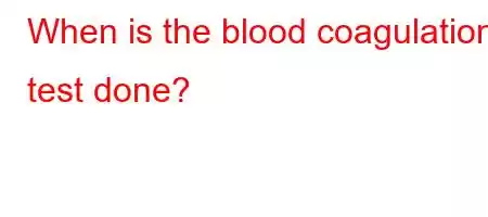 When is the blood coagulation test done?