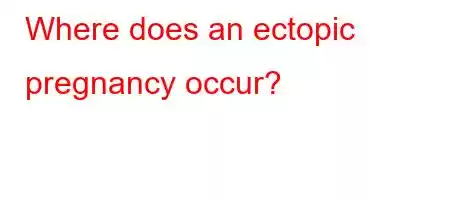 Where does an ectopic pregnancy occur?